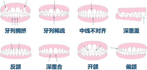 牙齿整形对人体有哪些危害？
