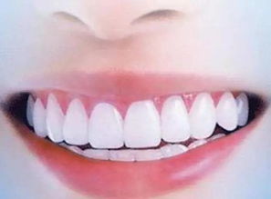 牙齿整形一般需要多长时间？