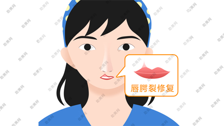 唇裂修复手术的特点有哪些呢？