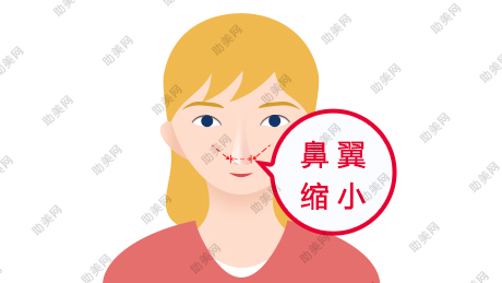 <a href='/tag_biyisuoxiaoshou11.html'>鼻翼缩小手术</a>有几种方法呢？