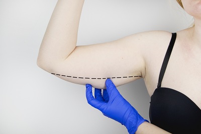 瘦手臂的快方法做手臂吸脂有哪些副作用及如何规避？