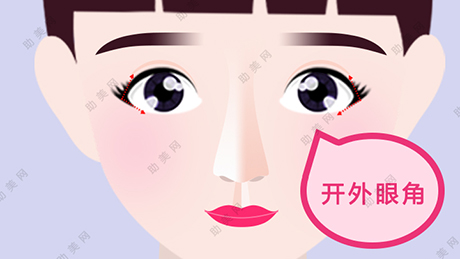 开<a href='/tag_waiyanjiaoshoushu.html'>外眼角手术</a>的手术注意点是什么？