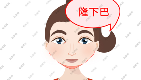 上海美莱隆下巴的方式有哪些？