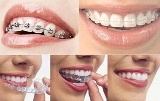 广州哪里做牙齿矫正比较好?