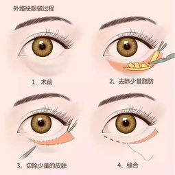 韩美激光祛眼袋会不会损害眼周的肌肤啊，会使皱纹增加吗