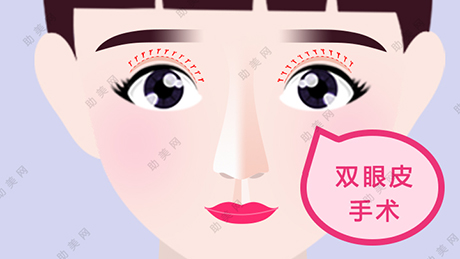 江汉王绍光双眼皮手术方法有几种